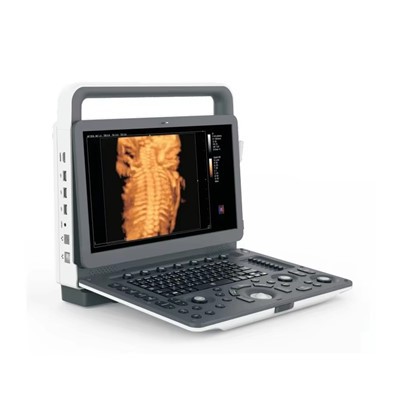 Zonecare M30 15.6 inch draagbaar kleurendoppler-echografieapparaat